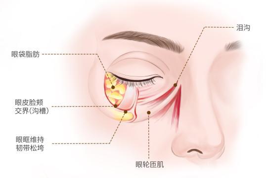 老的标志去除眼袋焕发青春光彩尊龙AG网站眼袋不是自然衰(图1)